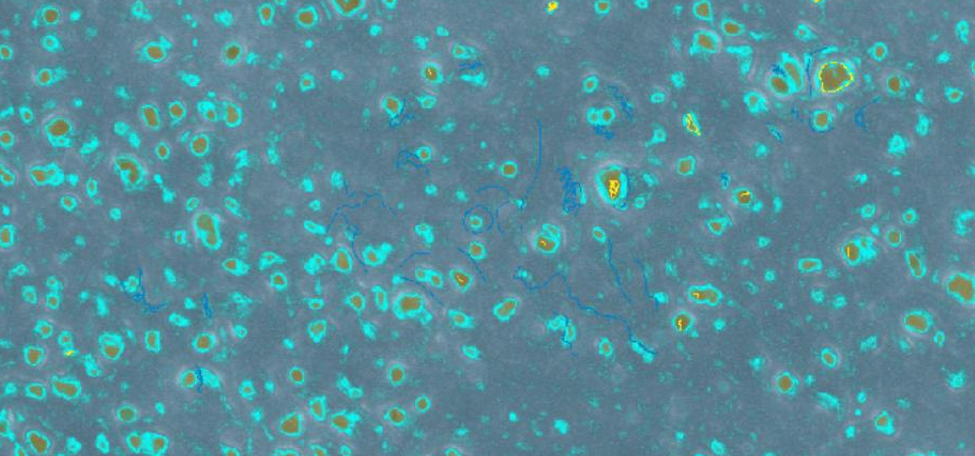 VIPER-M: VIrus Predictive rEtention via advanced poRe analysis in Membranes